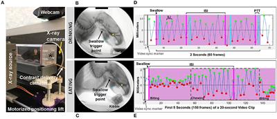 Persistent Feeding and Swallowing Deficits in a Mouse Model of 22q11.2 Deletion Syndrome